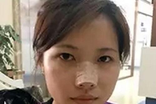 整容医生爆料视频下载,医生亲述幕后真相与风险  第2张